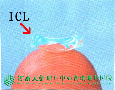 ICL植入術，高度近視患者的福音