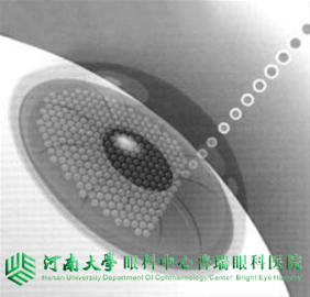 近視度數(shù)不同，手術方式怎么選