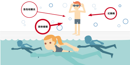 夏季當(dāng)心紅眼病，網(wǎng)吧泳池成高發(fā)區(qū)