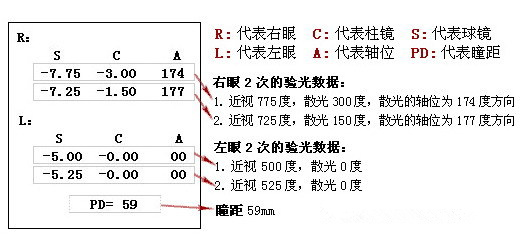 眼科醫(yī)生教你如何一分鐘看懂驗(yàn)光單！