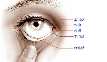 淚道病，眼部的隱形威脅