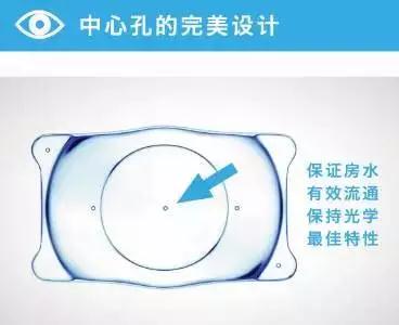 高度近視的“終結(jié)者”——ICL晶體植入術！