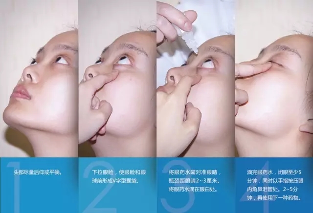 眼藥水你點(diǎn)對了嗎？快來看看！