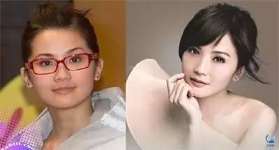 那些近視戴鏡暴丑的女明星們是做了什么變美了？？？